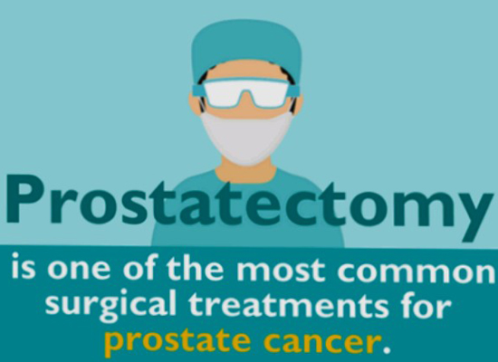 prostatectomy for prostate cancer
