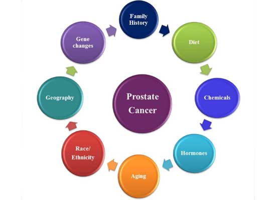risk factors for prostate cancer
