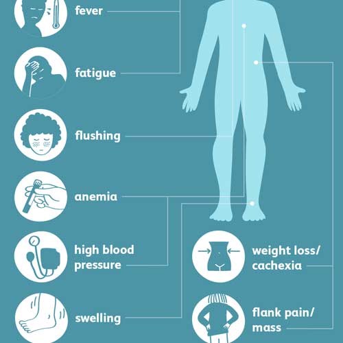 symptoms of renal cell cancer