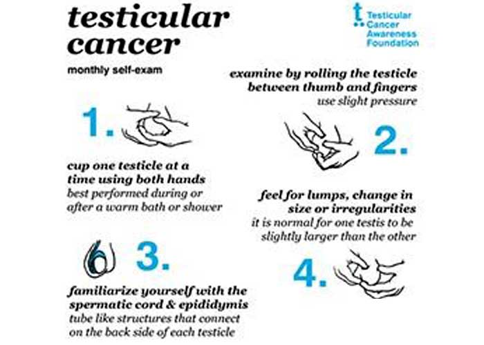 self examination protocol for testicular cancers