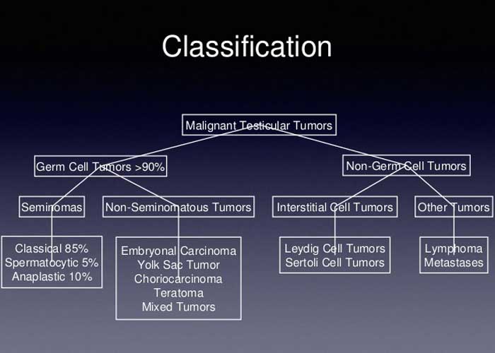 classification of testicular cancers