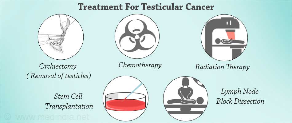 treatment of testicular cancers