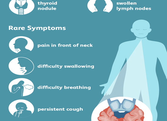 symptoms of thyroid cancer